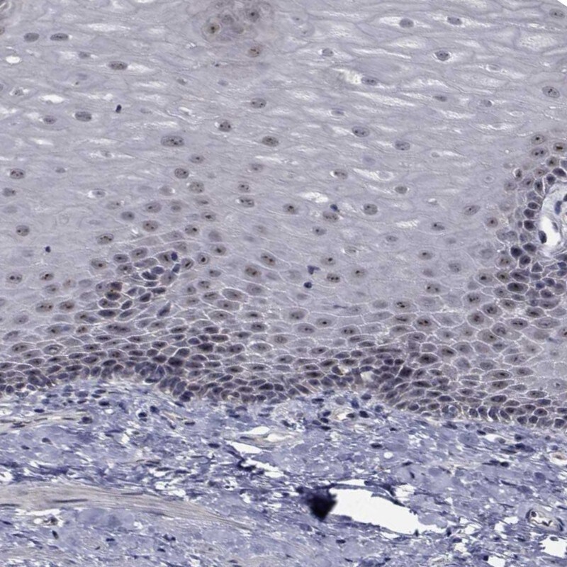 NVL Antibody - BSA Free Immunohistochemistry-Paraffin: NVL Antibody - BSA Free [NBP1-89508]