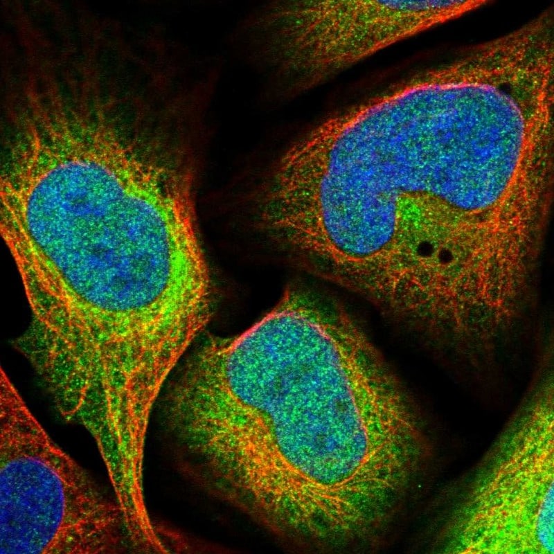 FDPS Antibody - BSA Free Immunocytochemistry/ Immunofluorescence: FDPS Antibody - BSA Free [NBP1-89509]