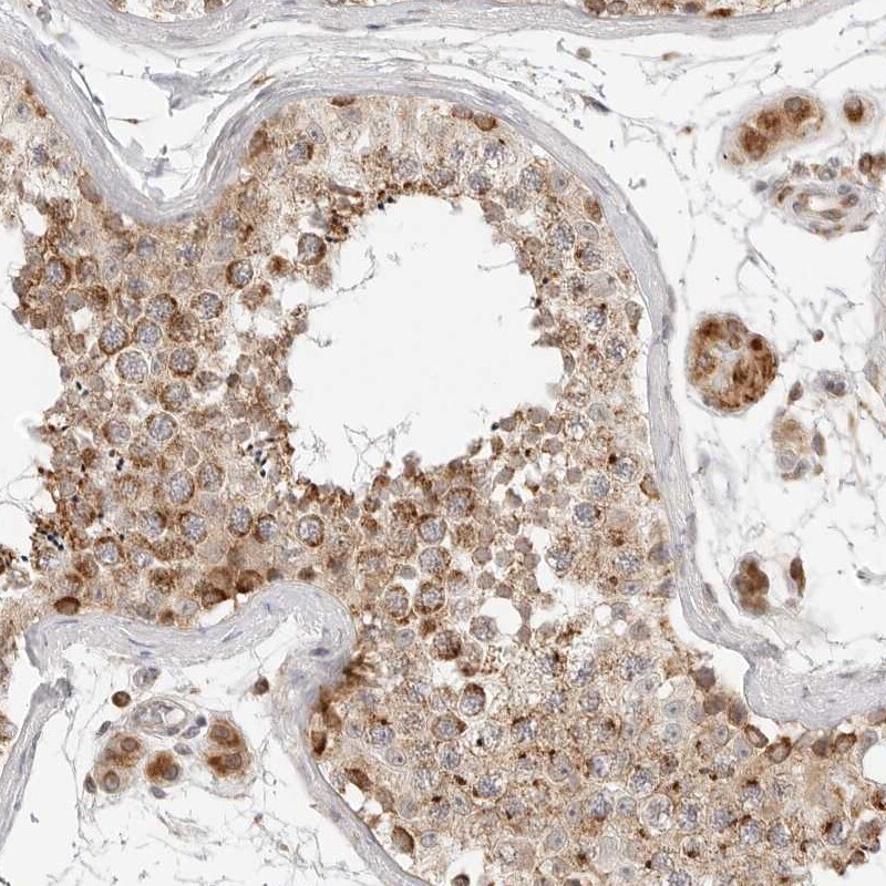 DYRK4 Antibody - BSA Free Immunohistochemistry-Paraffin: DYRK4 Antibody - BSA Free [NBP1-89511]