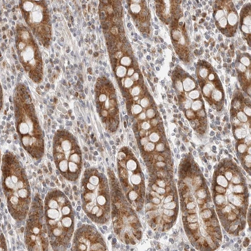 DYRK4 Antibody - BSA Free Immunohistochemistry-Paraffin: DYRK4 Antibody - BSA Free [NBP1-89511]