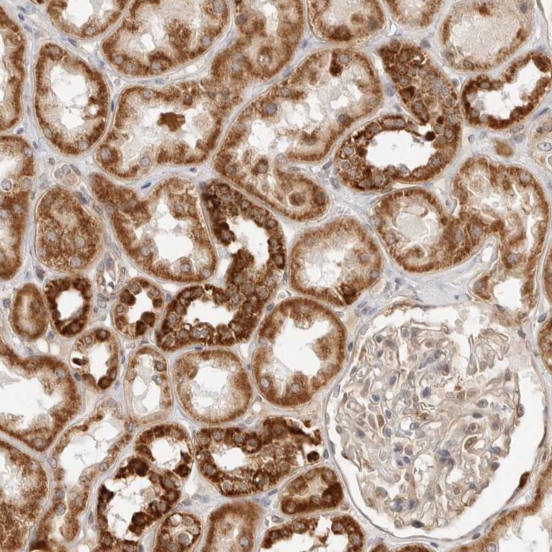 DYRK4 Antibody - BSA Free Immunohistochemistry-Paraffin: DYRK4 Antibody - BSA Free [NBP1-89511]
