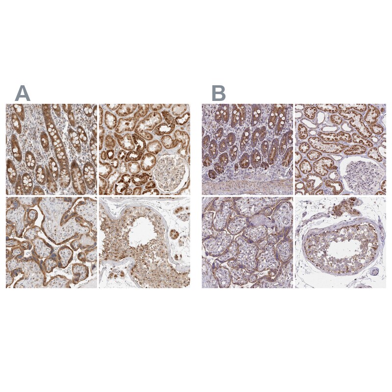 DYRK4 Antibody - BSA Free Immunohistochemistry-Paraffin: DYRK4 Antibody - BSA Free [NBP1-89511]