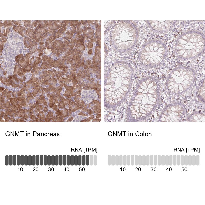 Glycine N-Methyltransferase/GNMT Antibody - BSA Free Immunohistochemistry-Paraffin: Glycine N-Methyltransferase/GNMT Antibody - BSA Free [NBP1-89512]