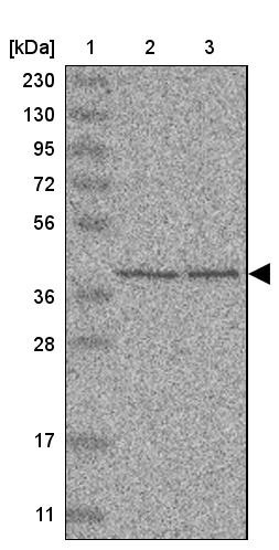 UROD Antibody - BSA Free Western Blot: UROD Antibody - BSA Free [NBP1-89513]
