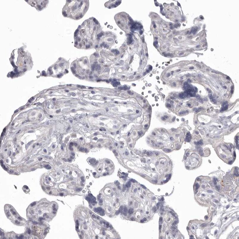 MDH1 Antibody - BSA Free Immunohistochemistry-Paraffin: MDH1 Antibody - BSA Free [NBP1-89515]