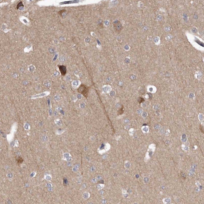 MDH1 Antibody - BSA Free Immunohistochemistry-Paraffin: MDH1 Antibody - BSA Free [NBP1-89515]