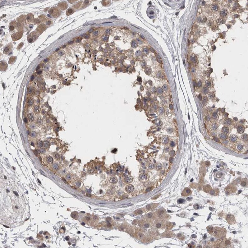APRT Antibody - BSA Free Immunohistochemistry-Paraffin: APRT Antibody - BSA Free [NBP1-89519]