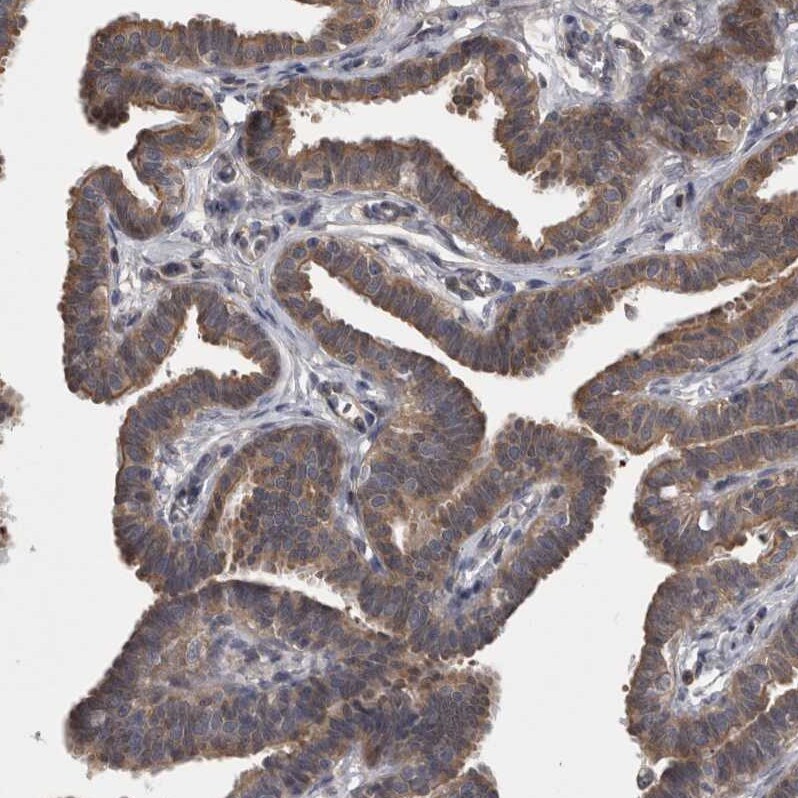 APRT Antibody - BSA Free Immunohistochemistry-Paraffin: APRT Antibody - BSA Free [NBP1-89519]