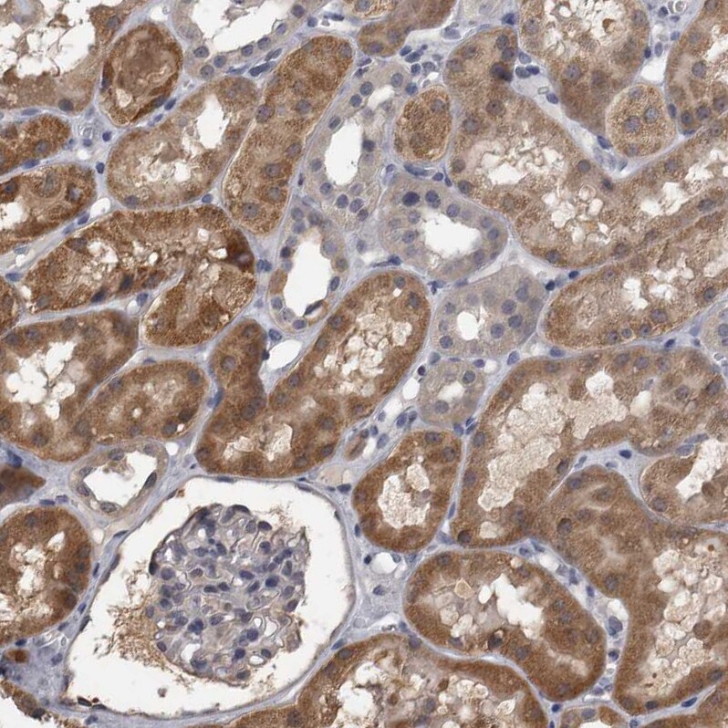 APRT Antibody - BSA Free Immunohistochemistry-Paraffin: APRT Antibody - BSA Free [NBP1-89519]