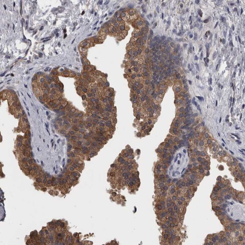 APRT Antibody - BSA Free Immunohistochemistry-Paraffin: APRT Antibody - BSA Free [NBP1-89519]