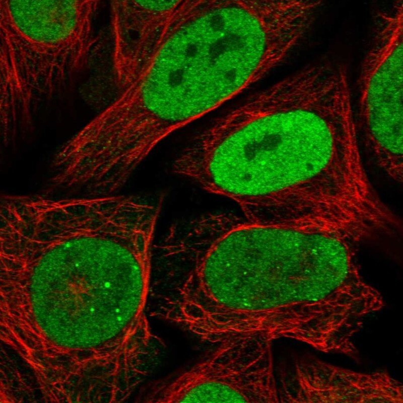 RPA2 Antibody - BSA Free Immunocytochemistry/ Immunofluorescence: RPA2 Antibody [NBP1-89524]