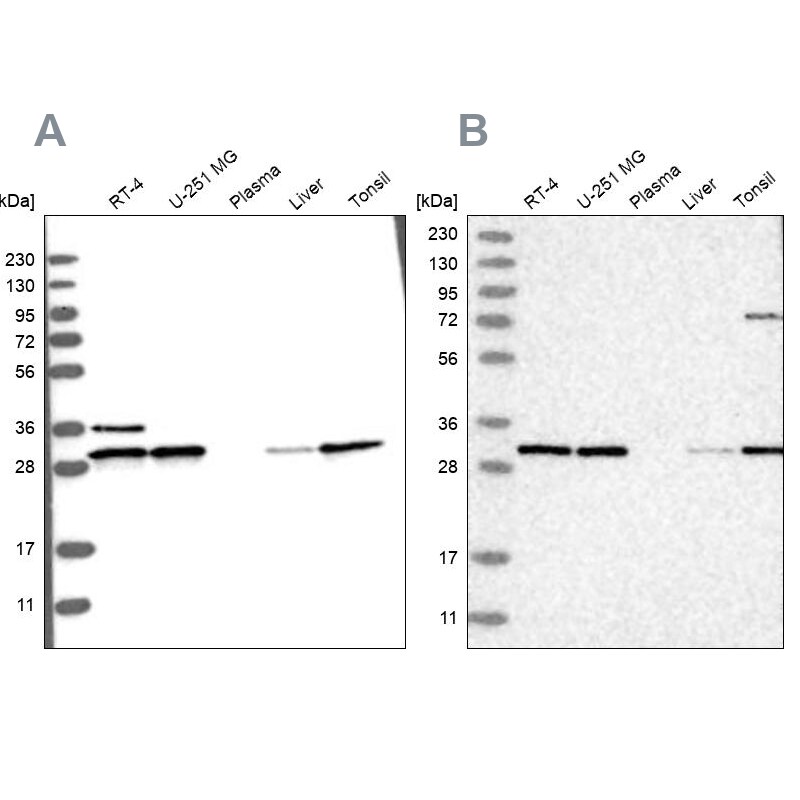 RPA2 Antibody - BSA Free Western Blot: RPA2 Antibody - BSA Free [NBP1-89524]