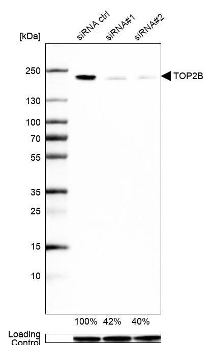 TOP2B Antibody - BSA Free Western Blot: TOP2B Antibody - BSA Free [NBP1-89527]