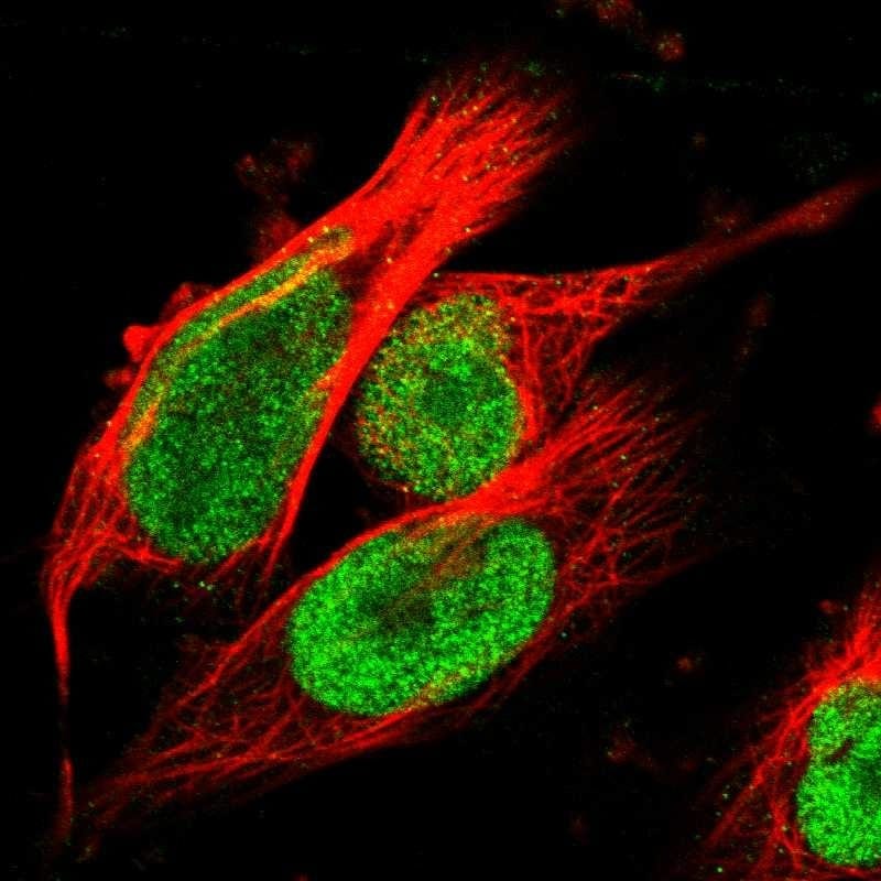 TOP2B Antibody - BSA Free Immunocytochemistry/ Immunofluorescence: TOP2B Antibody - BSA Free [NBP1-89527]