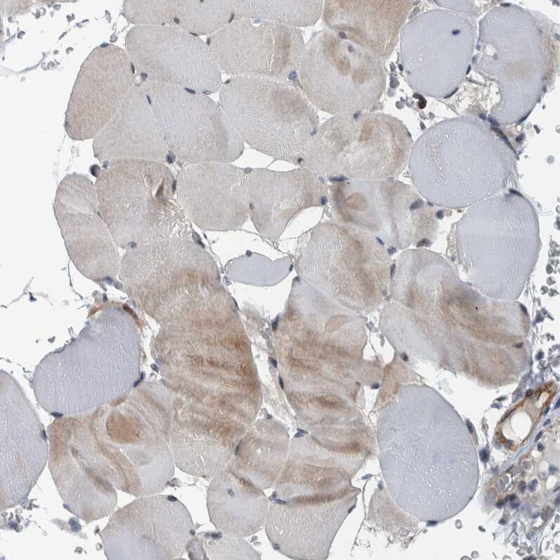 BAIAP2L1 Antibody - BSA Free Immunohistochemistry-Paraffin: BAIAP2L1 Antibody - BSA Free [NBP1-89528]