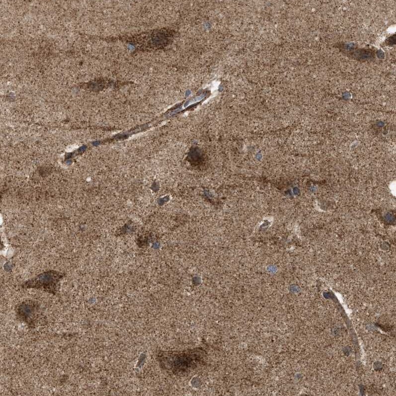 Sirtuin 5/SIRT5 Antibody - BSA Free Immunohistochemistry-Paraffin: Sirtuin 5/SIRT5 Antibody - BSA Free [NBP1-89535]