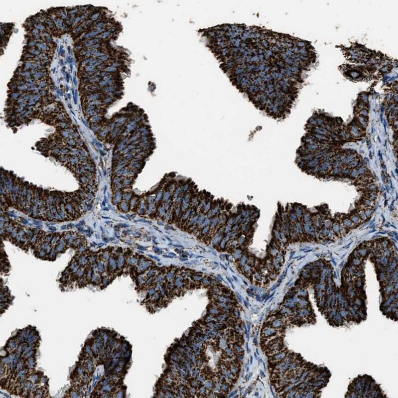 MDH2 Antibody - BSA Free Immunohistochemistry-Paraffin: MDH2 Antibody - BSA Free [NBP1-89539]