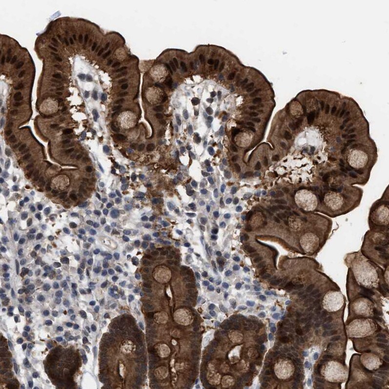 BAIAP2L1 Antibody - BSA Free Immunohistochemistry-Paraffin: BAIAP2L1 Antibody - BSA Free [NBP1-89542]