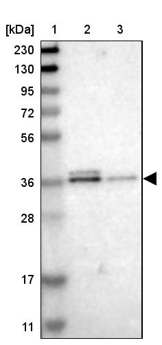 SCAMP2 Antibody - BSA Free Western Blot: SCAMP2 Antibody - BSA Free [NBP1-89543]