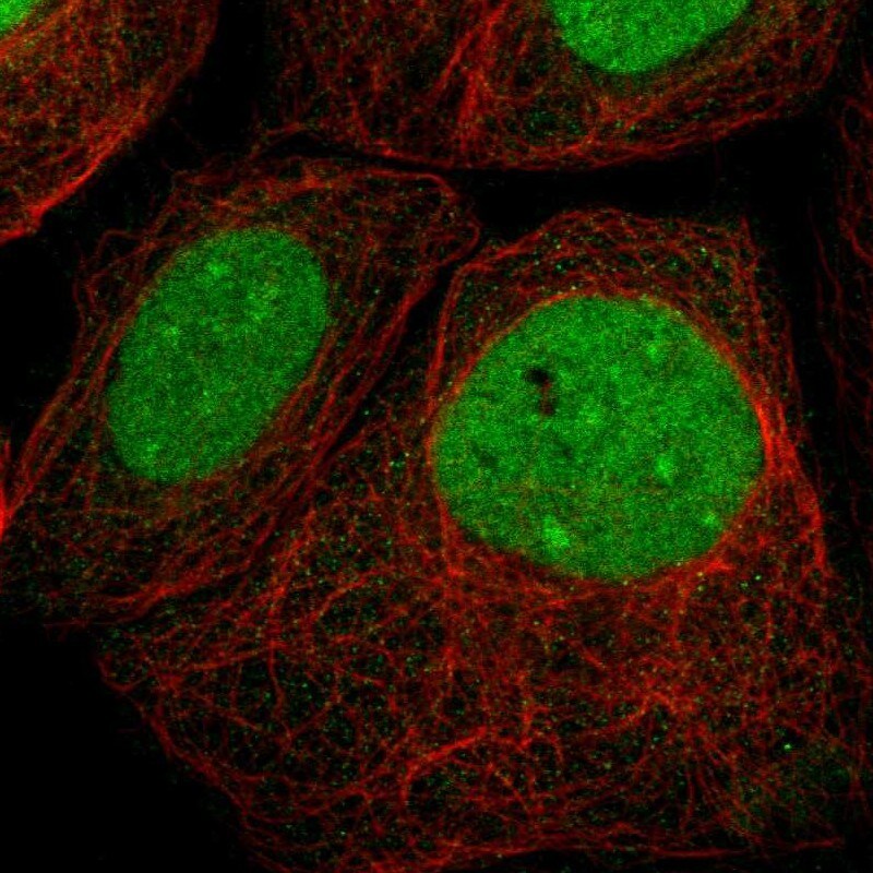VRK1 Antibody Immunocytochemistry/ Immunofluorescence: VRK1 Antibody [VRK1 Antibody]