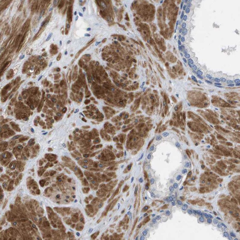 LPP Antibody - BSA Free Immunohistochemistry-Paraffin: LPP Antibody - BSA Free [NBP1-89549]