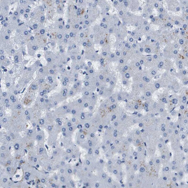 LPP Antibody - BSA Free Immunohistochemistry-Paraffin: LPP Antibody - BSA Free [NBP1-89549]