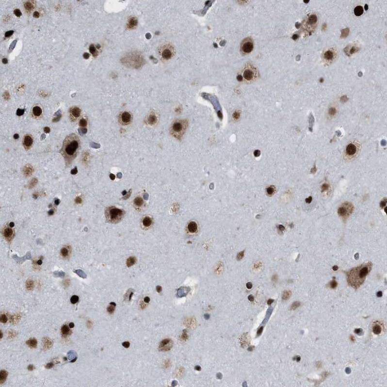 ZNF207 Antibody - BSA Free Immunohistochemistry-Paraffin: ZNF207 Antibody - BSA Free [NBP1-89550]