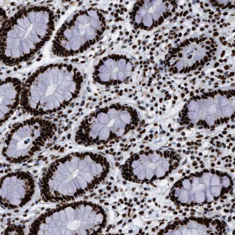 ZNF207 Antibody - BSA Free Immunohistochemistry-Paraffin: ZNF207 Antibody - BSA Free [NBP1-89550]