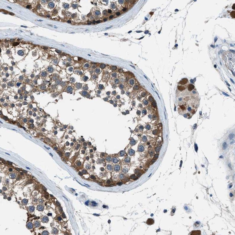 LMW-PTP/ACP1 Antibody - BSA Free Immunohistochemistry-Paraffin: LMW-PTP/ACP1 Antibody [NBP1-89551]