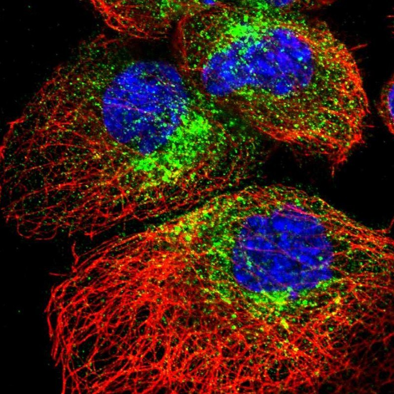 SCAMP2 Antibody - BSA Free Immunocytochemistry/ Immunofluorescence: SCAMP2 Antibody [NBP1-89552]