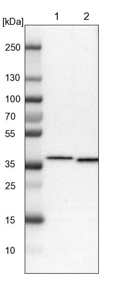 SCAMP2 Antibody - BSA Free Western Blot: SCAMP2 Antibody - BSA Free [NBP1-89552]
