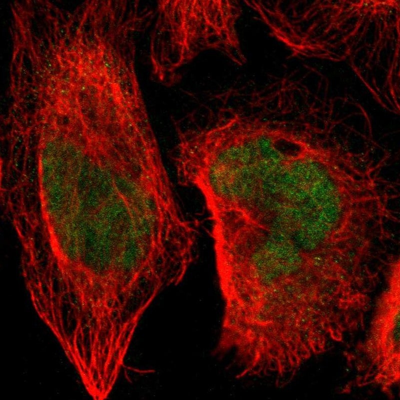 SENP1 Antibody - BSA Free Immunocytochemistry/ Immunofluorescence: SENP1 Antibody - BSA Free [NBP1-89553]