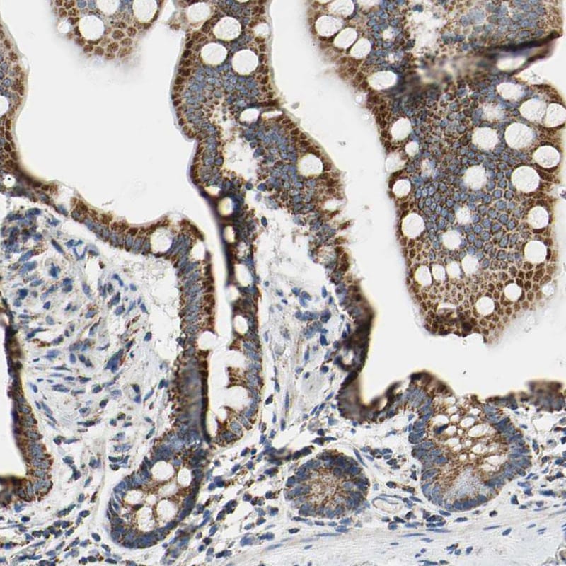 CLPP Antibody - BSA Free Immunohistochemistry-Paraffin: CLPP Antibody [NBP1-89557]