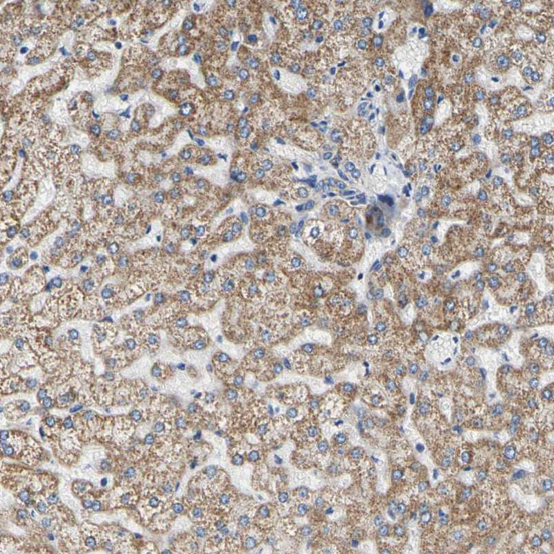 CLPP Antibody - BSA Free Immunohistochemistry-Paraffin: CLPP Antibody [NBP1-89557]