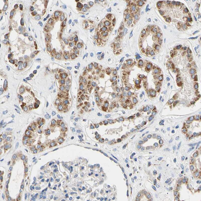 CLPP Antibody - BSA Free Immunohistochemistry-Paraffin: CLPP Antibody [NBP1-89557]