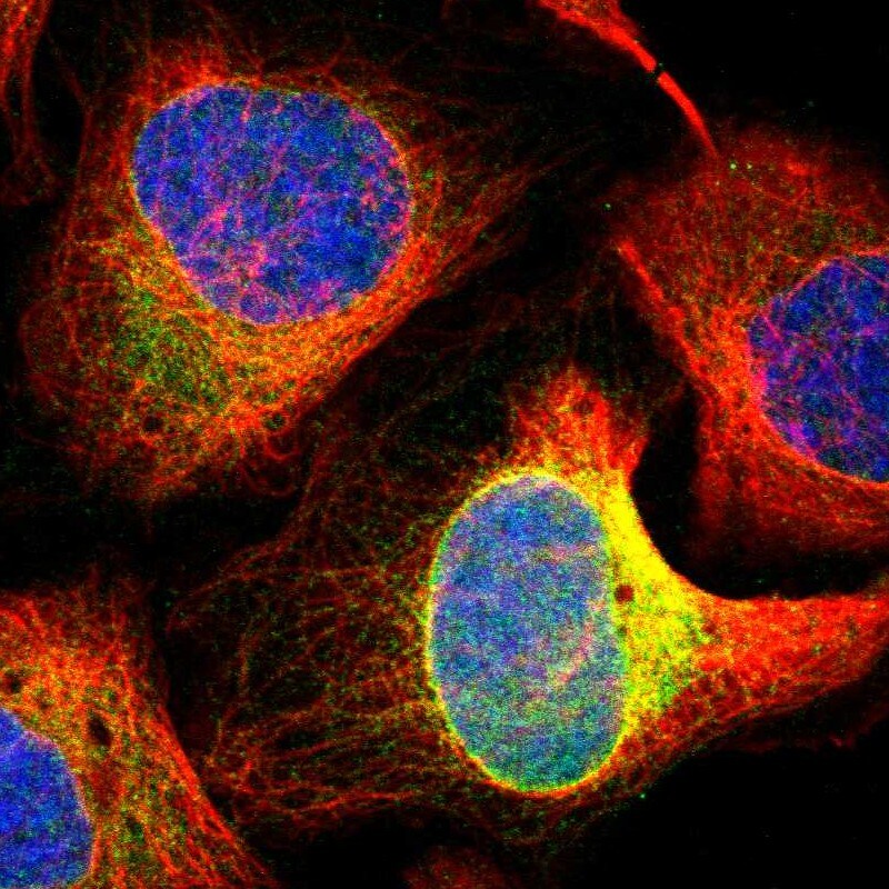 FDFT1 Antibody - BSA Free Immunocytochemistry/ Immunofluorescence: FDFT1 Antibody [NBP1-89560]