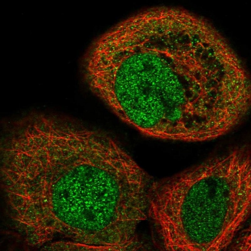 Sin1/MAPKAP1 Antibody - BSA Free Immunocytochemistry/ Immunofluorescence: Sin1/MAPKAP1 Antibody [NBP1-89568]