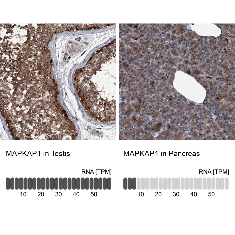 Sin1/MAPKAP1 Antibody - BSA Free Immunohistochemistry-Paraffin: Sin1/MAPKAP1 Antibody - BSA Free [NBP1-89569]