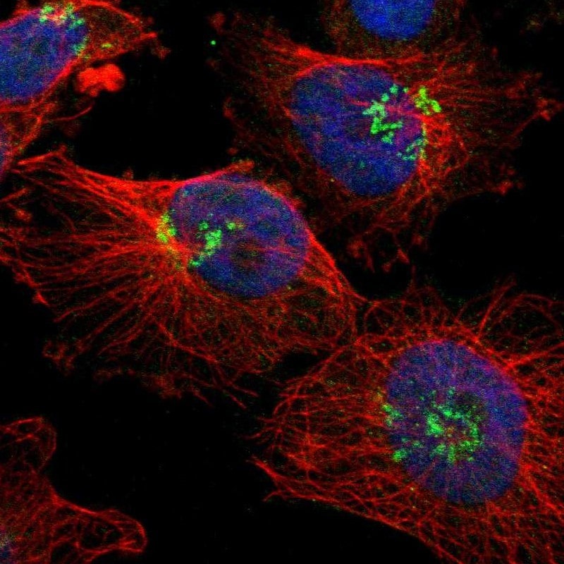 Ajuba Antibody - BSA Free Immunocytochemistry/ Immunofluorescence: Ajuba Antibody - BSA Free [NBP1-89570]