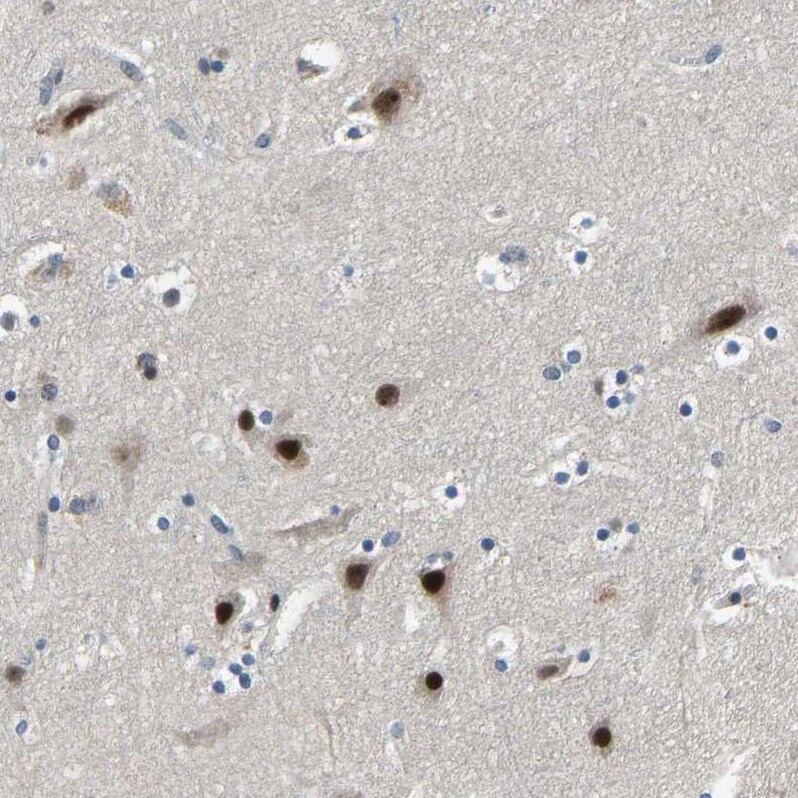 RNF12 Antibody - BSA Free Immunohistochemistry-Paraffin: RNF12 Antibody - BSA Free [NBP1-89571]