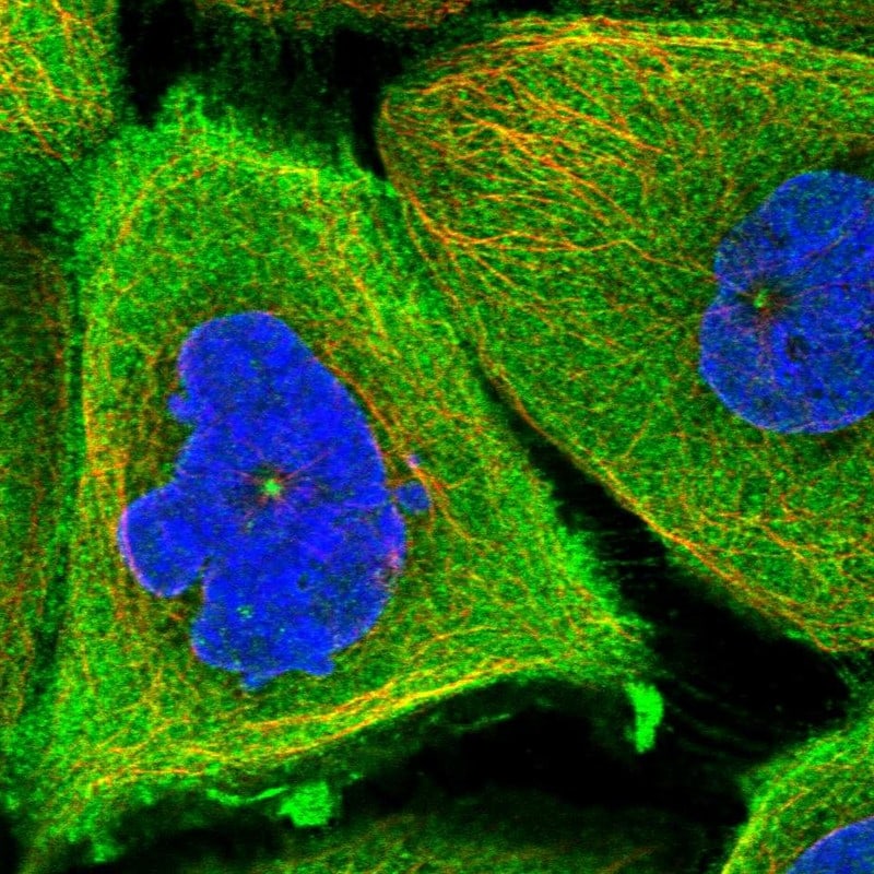 TCHP Antibody - BSA Free Immunocytochemistry/ Immunofluorescence: TCHP Antibody - BSA Free [NBP1-89572]