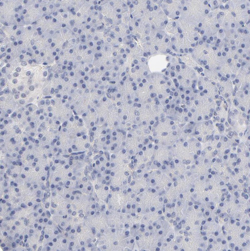 MCT1/SLC16A1 Antibody - BSA Free Immunohistochemistry-Paraffin: MCT1/SLC16A1 Antibody - BSA Free [NBP1-89574]