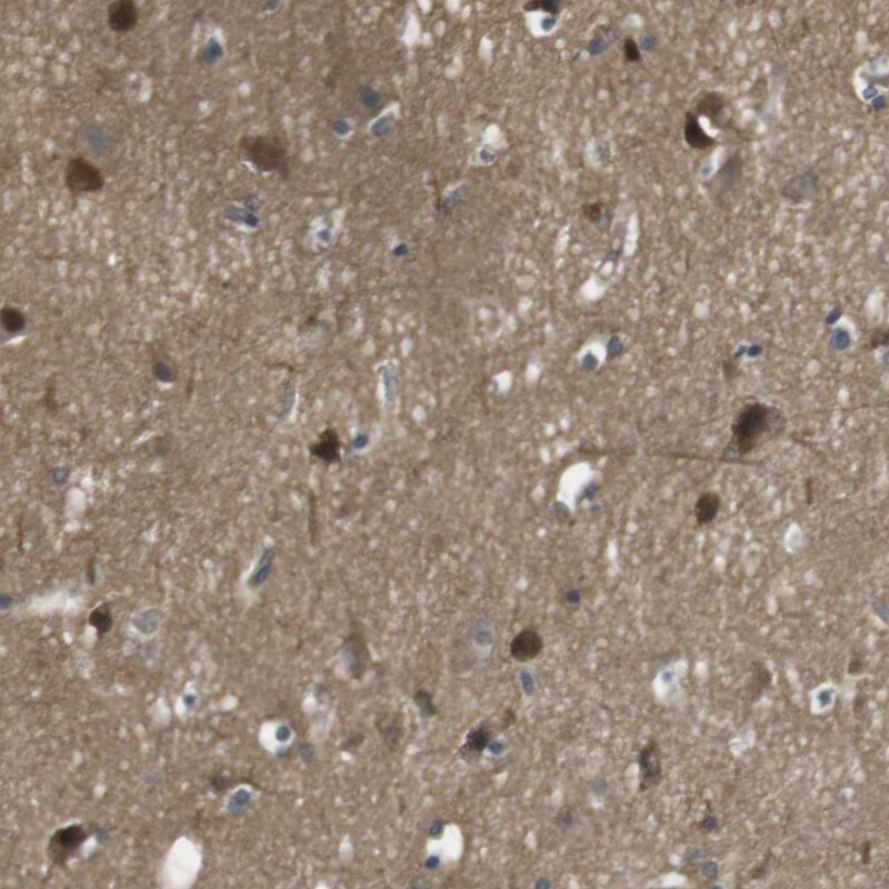 LRRC3B/LRP15 Antibody - BSA Free Immunohistochemistry-Paraffin: LRRC3B/LRP15 Antibody - BSA Free [NBP1-89579]