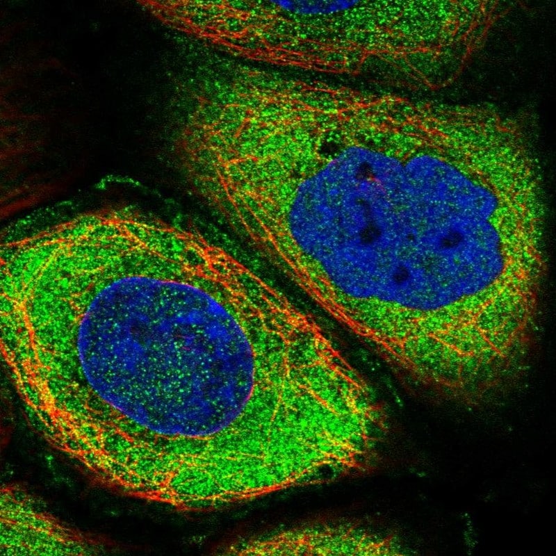 Roquin Antibody - BSA Free Immunocytochemistry/ Immunofluorescence: Roquin Antibody - BSA Free [NBP1-89589]