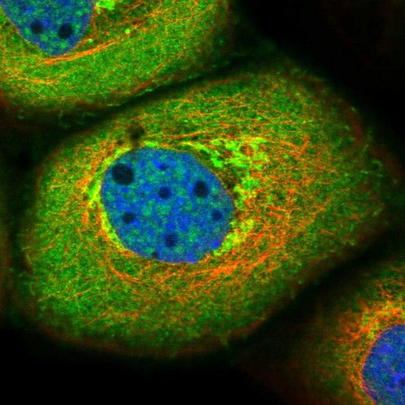 Roquin Antibody - BSA Free Immunocytochemistry/ Immunofluorescence: Roquin Antibody [NBP1-89591]