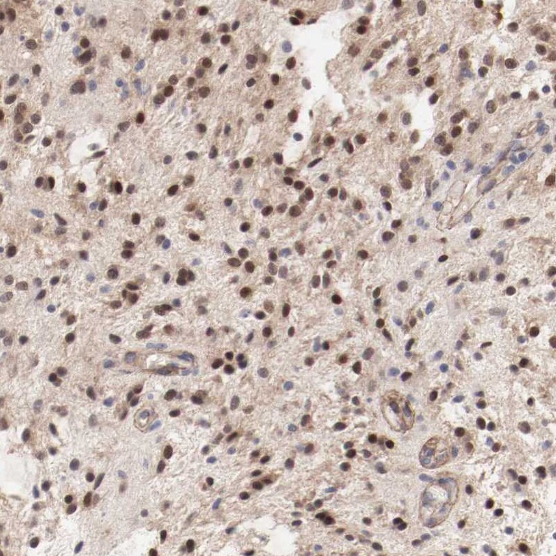 MAGED4B Antibody - BSA Free Immunohistochemistry-Paraffin: MAGED4B Antibody - BSA Free [NBP1-89594]