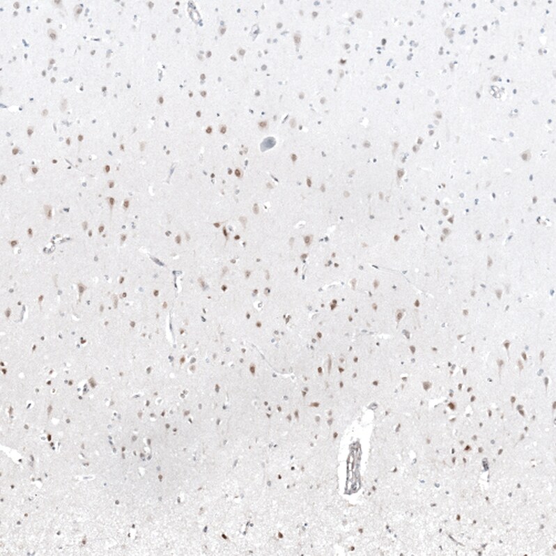 MAGED4B Antibody - BSA Free Immunohistochemistry-Paraffin: MAGED4B Antibody - BSA Free [NBP1-89594]