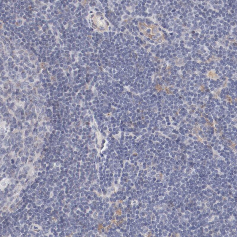 MAGED4B Antibody - BSA Free Immunohistochemistry-Paraffin: MAGED4B Antibody - BSA Free [NBP1-89594]