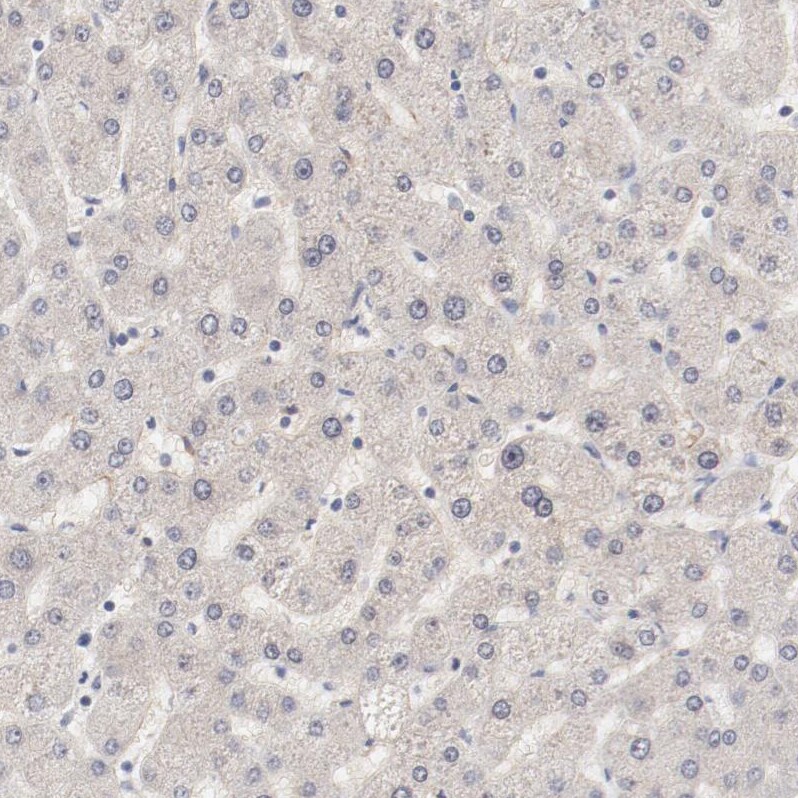 MAGED4B Antibody - BSA Free Immunohistochemistry-Paraffin: MAGED4B Antibody - BSA Free [NBP1-89594]