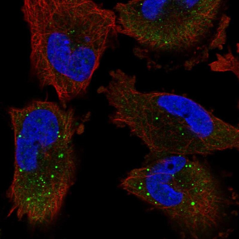 UNK Antibody - BSA Free Immunocytochemistry/ Immunofluorescence: UNK Antibody [NBP1-89595]